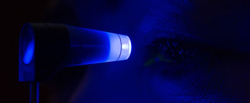 Close up of a man's eye with fluorescein dye