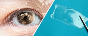 LASIK treatment of an eye vs Implantable Collamer Lens