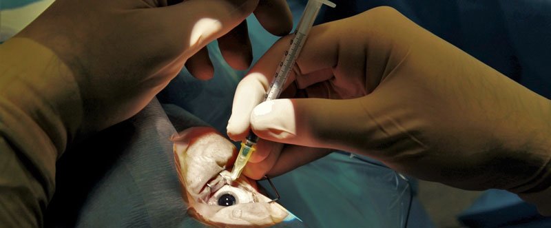 Surgeon injecting anti-VEGF agents in the eye